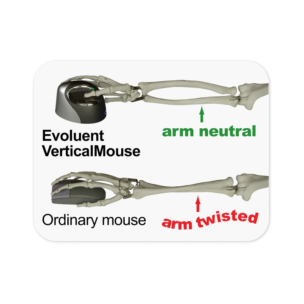 Evoluent Vertical Mouse 4